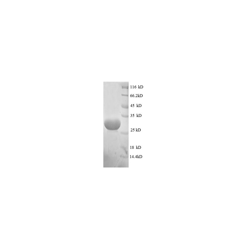 E. coli rpmG protein