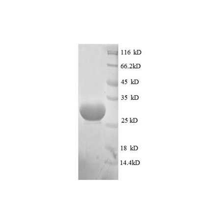 E. coli rpmG protein