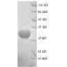 E. coli rpmG protein