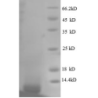 E. coli rpmG protein