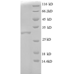 E. coli rpmD protein