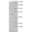 E. coli rpmD protein