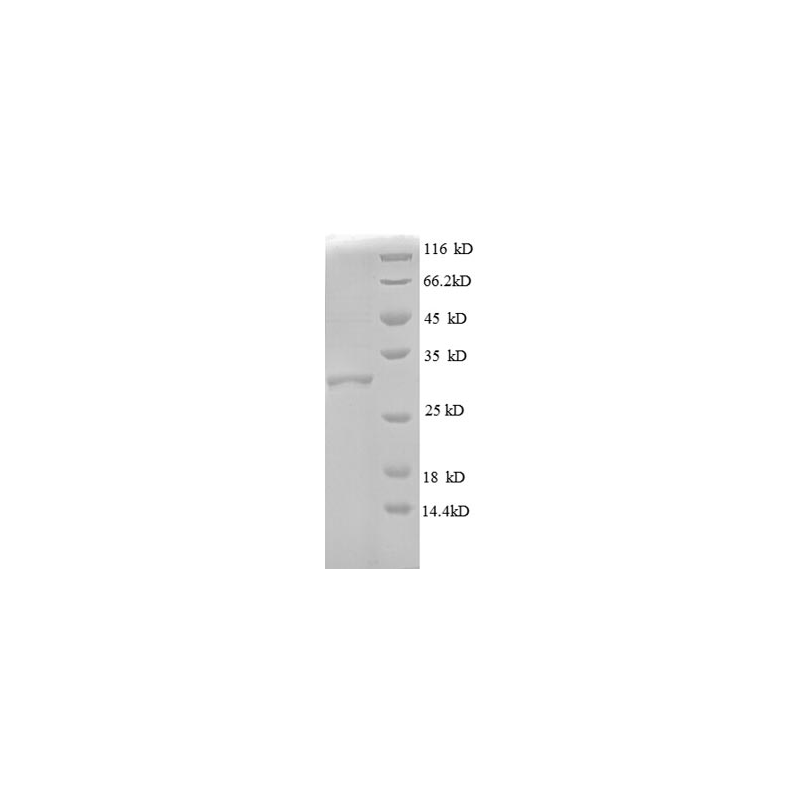 E. coli rpmD protein