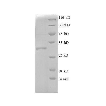 E. coli rpmD protein