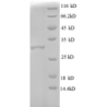 E. coli rpmD protein