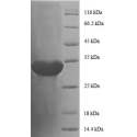 E. coli rpmC protein