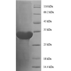 E. coli rpmC protein