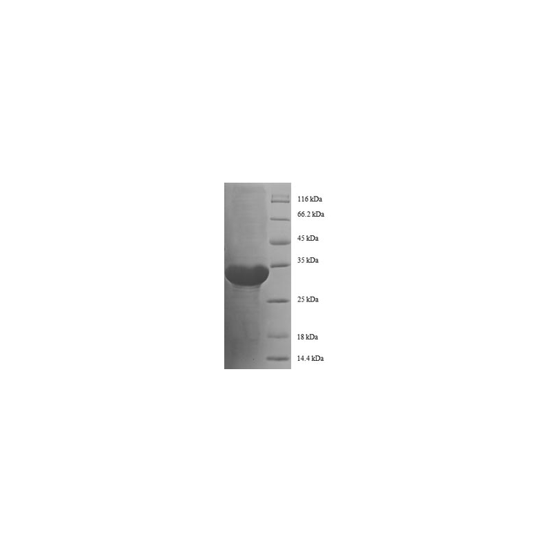 E. coli rpmC protein