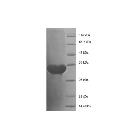 E. coli rpmC protein