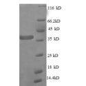 E. coli rpmA protein