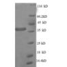 E. coli rpmA protein
