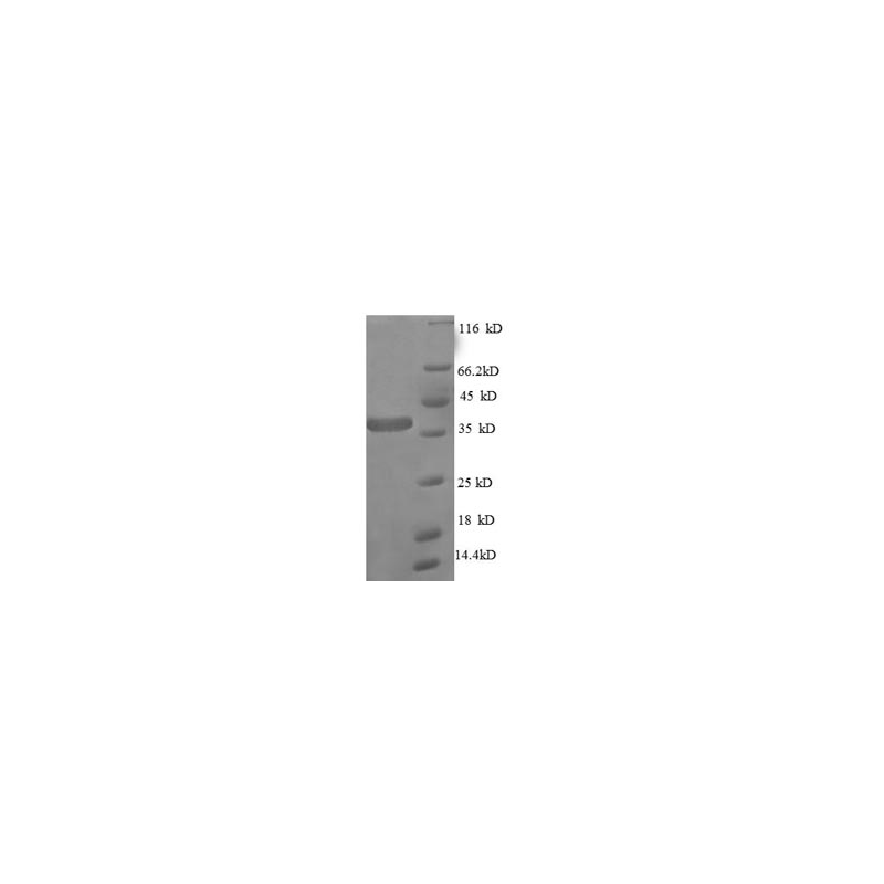 E. coli rpmA protein