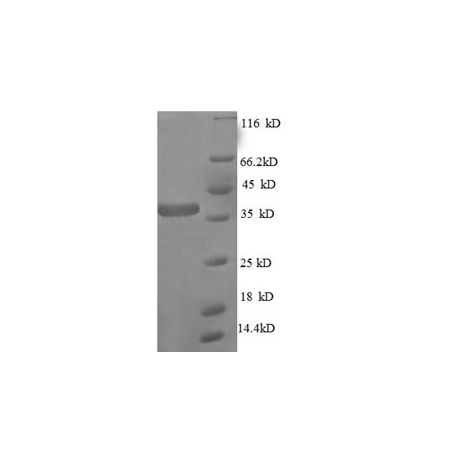 E. coli rpmA protein
