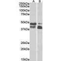 Goat anti-Tissue Factor Pathway Inhibitor Antibody