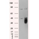 E.coli O6 Rabbit Polyclonal Antibody