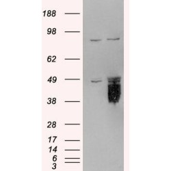 E.coli O6 Rabbit Polyclonal Antibody