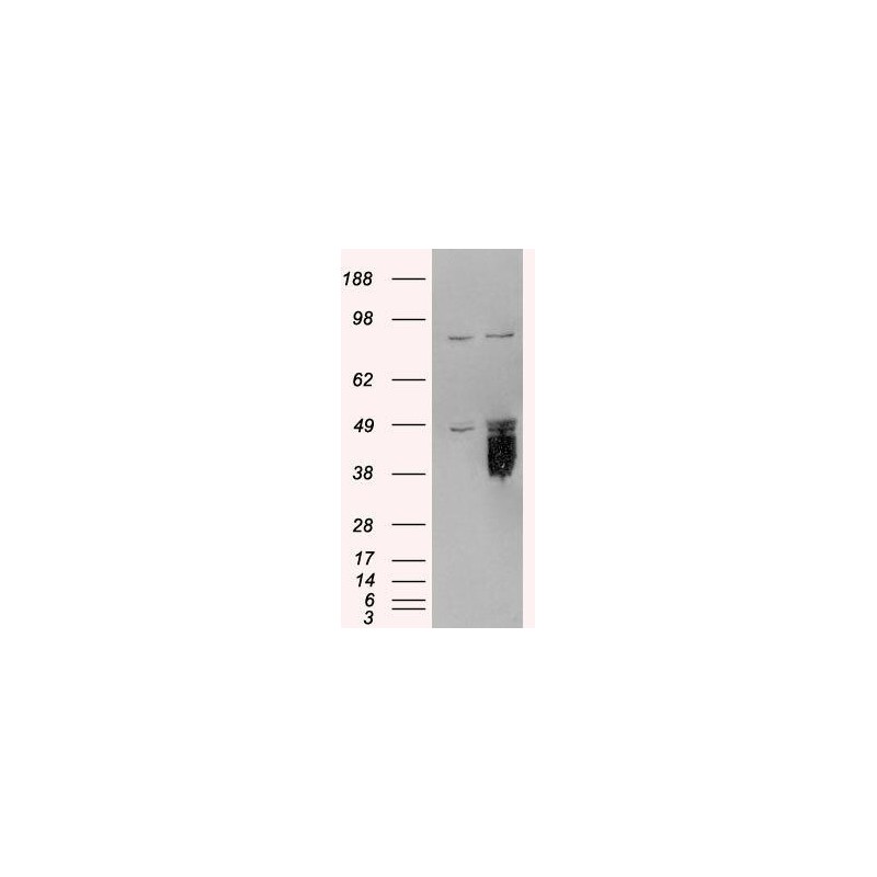 E.coli O6 Rabbit Polyclonal Antibody