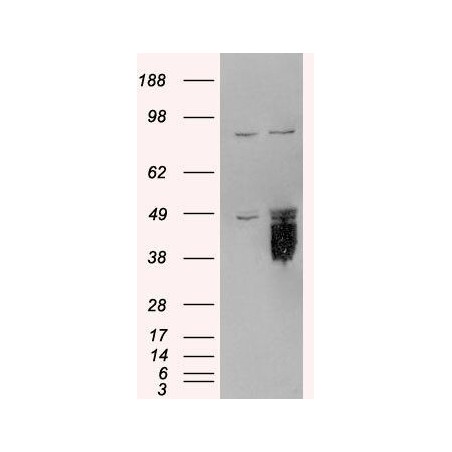 E.coli O6 Rabbit Polyclonal Antibody