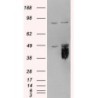 E.coli O6 Rabbit Polyclonal Antibody
