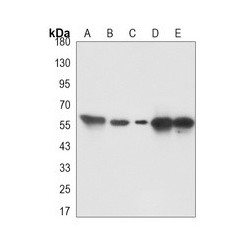 Thioredoxin Reductase, E.coli