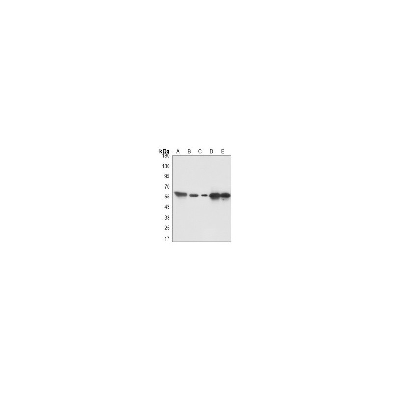 Thioredoxin Reductase, E.coli