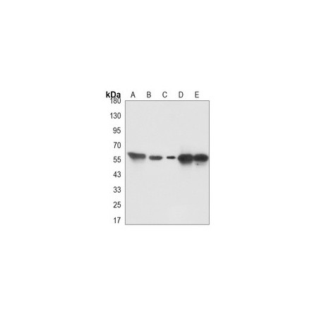 Thioredoxin Reductase, E.coli