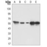 Thioredoxin Reductase, E.coli